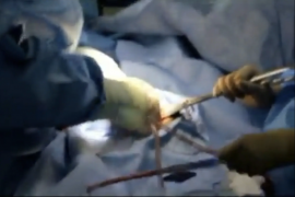 Un fermo immagine da un video girato clandestinamente che, secondo gli autori, testimonierebbe l'asportazione illegale di organi in Cina